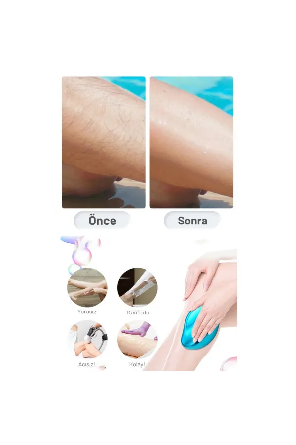 EPILATOR KRİSTAL TÜY ALMA EPİLATÖRÜ (5637) EPILATOR KRİSTAL TÜY ALMA EPİLATÖRÜ (5637)